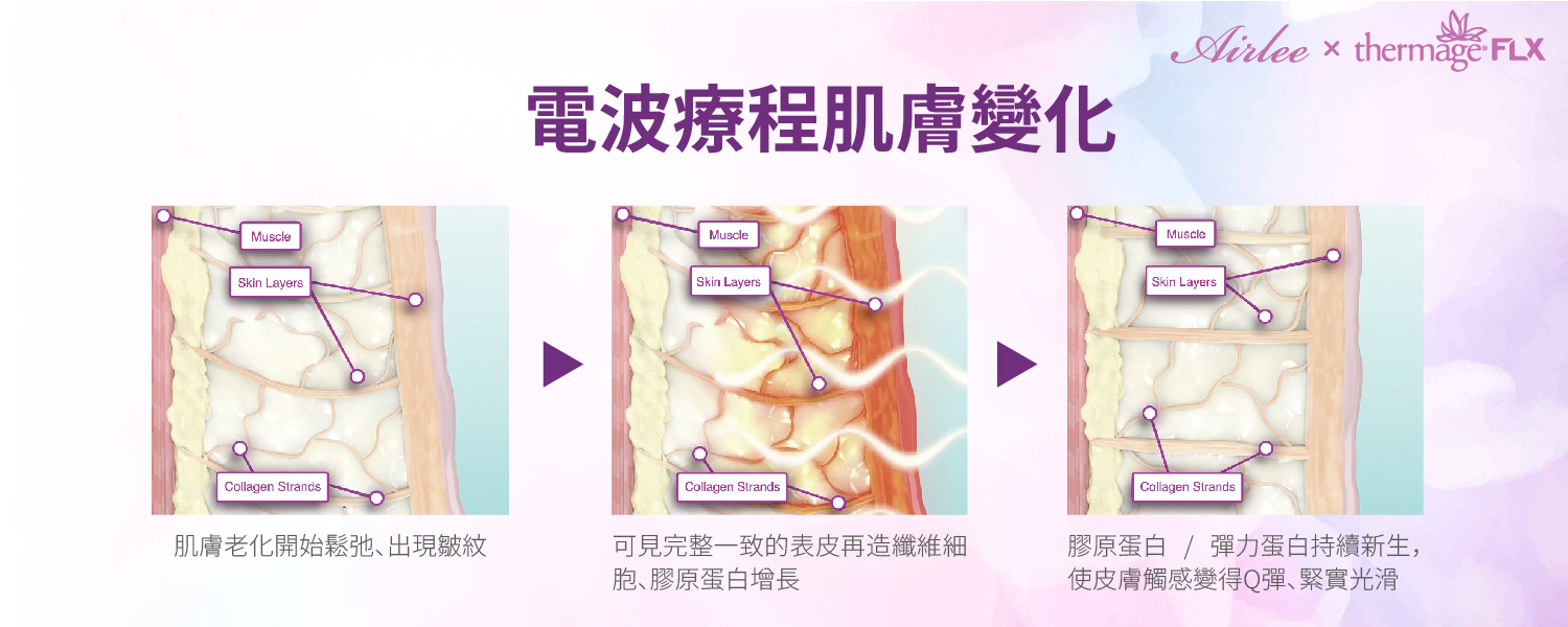 鳳凰電波術後