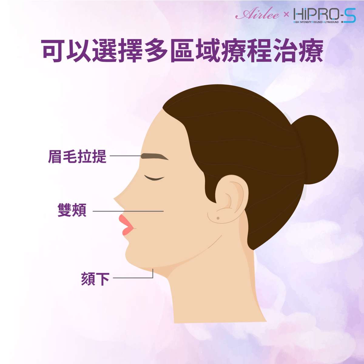 龍捲風音波