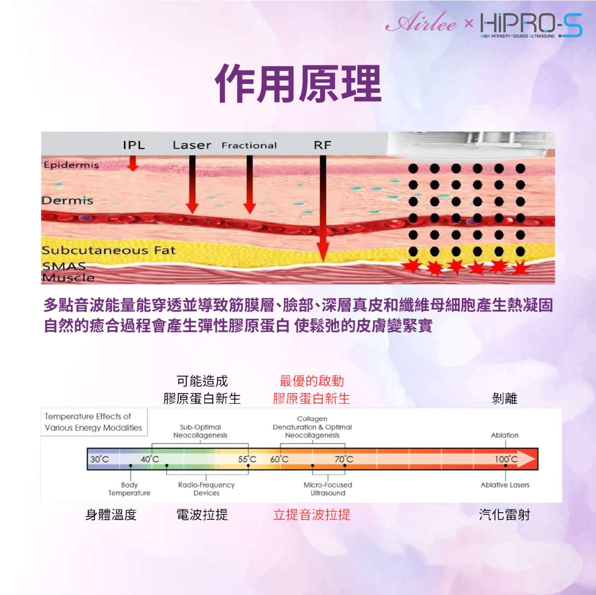 龍捲風音波